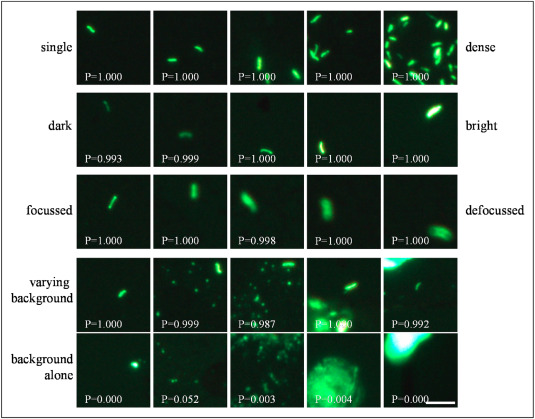 Publication: Machine-assisted interpretation of auramine stains