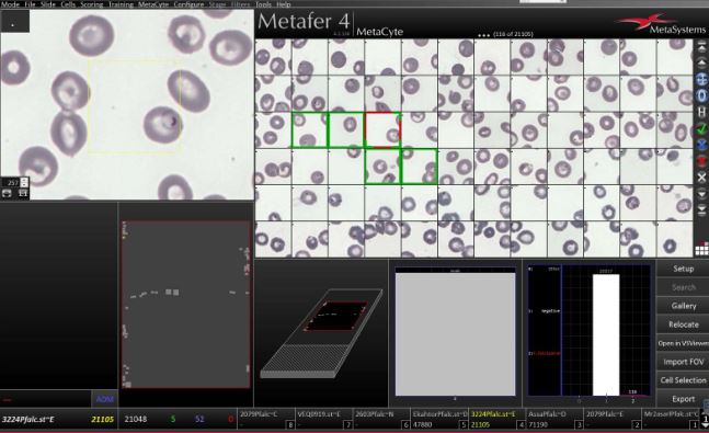 ePoster on Malaria Microscopy with Artificial Intelligence on ECCMID 2021